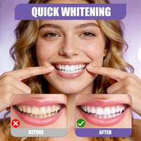 Purple Teeth Whitening Strips | Teeth Treatments 14 Strips | Whitens Teeth in 1 Use | Peroxide & Sensitivity-Free, Enamel-Safe Oral Care | PAP & Hydroxyapatite For Stain Removal | (Purple Teeth Whitening-14 Strips) (7)