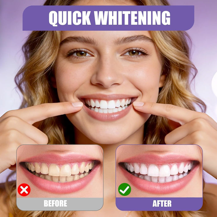Purple Teeth Whitening Strips | Teeth Treatments 14 Strips | Whitens Teeth in 1 Use | Peroxide & Sensitivity-Free, Enamel-Safe Oral Care | PAP & Hydroxyapatite For Stain Removal | (Purple Teeth Whitening-14 Strips) (7)