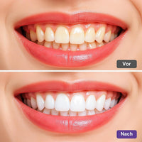 Purple Teeth Whitening Strips | Teeth Treatments 14 Strips | Whitens Teeth in 1 Use | Peroxide & Sensitivity-Free, Enamel-Safe Oral Care | PAP & Hydroxyapatite For Stain Removal | (Purple Teeth Whitening-14 Strips) (7)